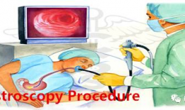 胃镜视频,直观呈现胃部健康状况